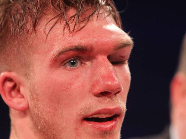 Nick Blackwell