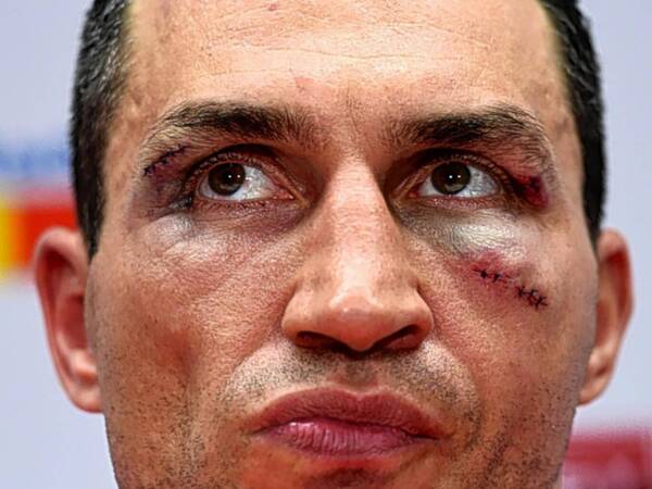 Wladimir-Klitschko